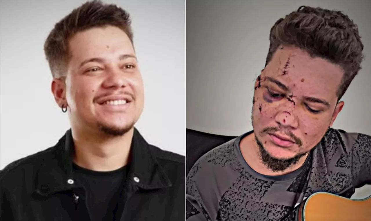 Sertanejo Benício é Agredido com Garrafa Após Show de Réveillon