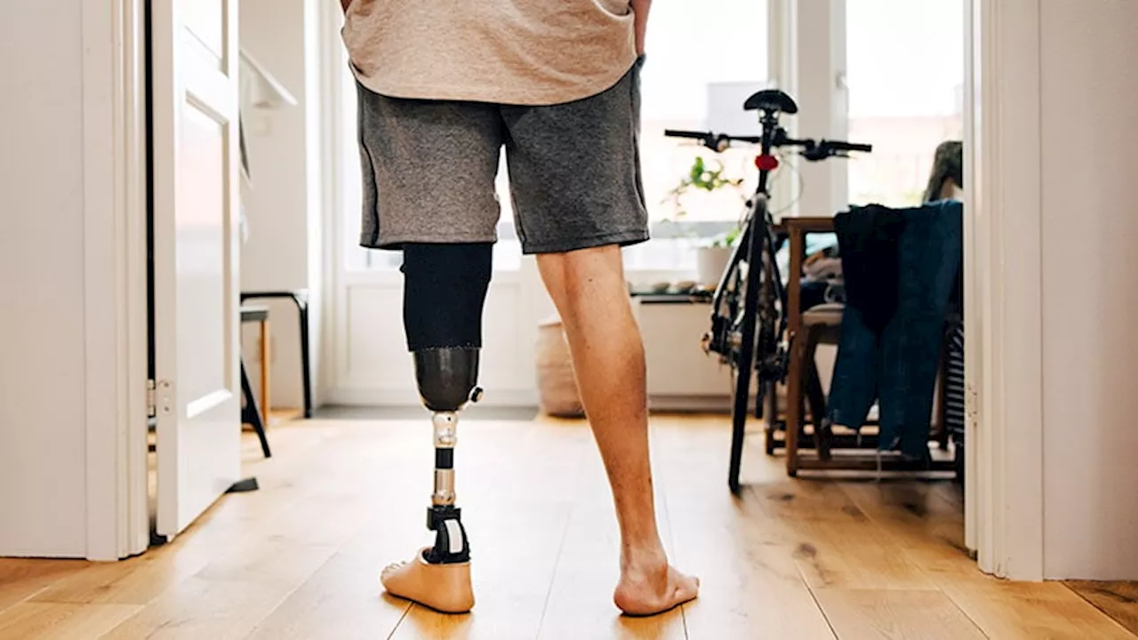 Health Insurance Denies Coverage for Advanced Prosthetic Limb