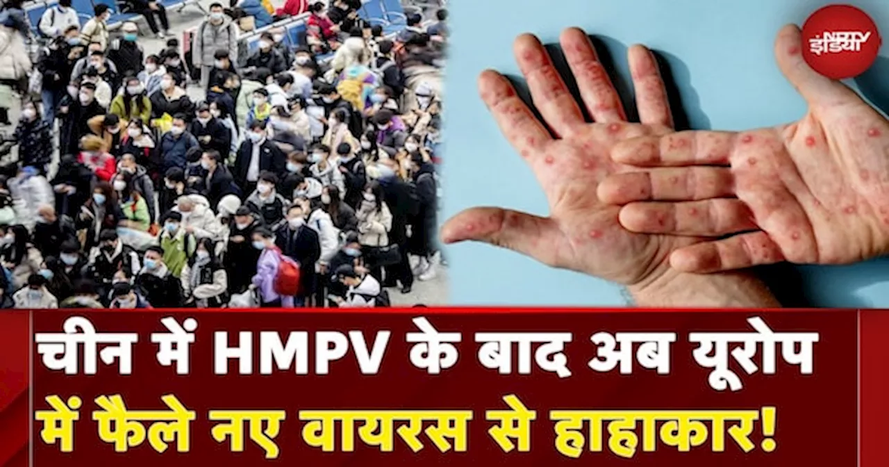 HMPV Virus: France में सामने आया Mpox वैरिएंट का पहला मामला | Monkeypox| Mpox Causes