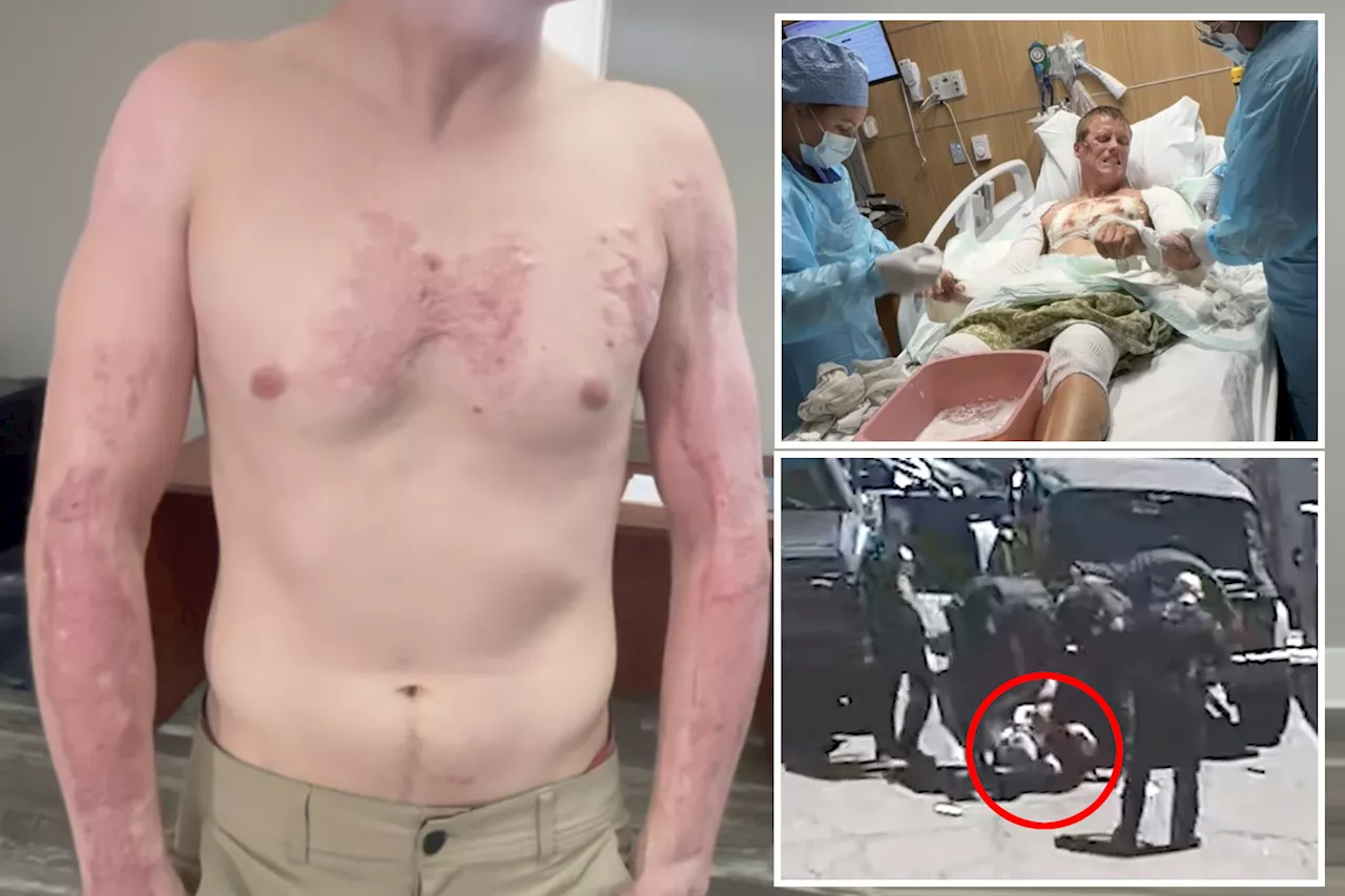 Arizona Man Suing Police After Third-Degree Burns From Asphalt