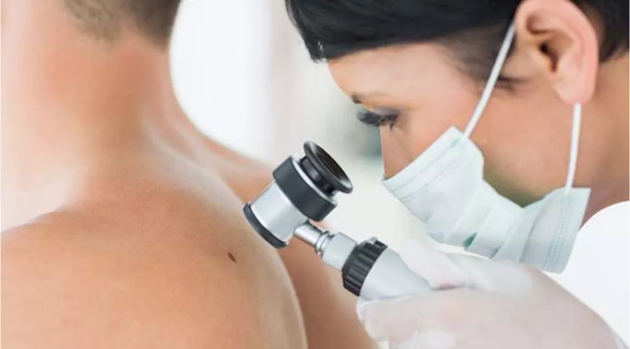 Melanoma: la minaccia anche in inverno