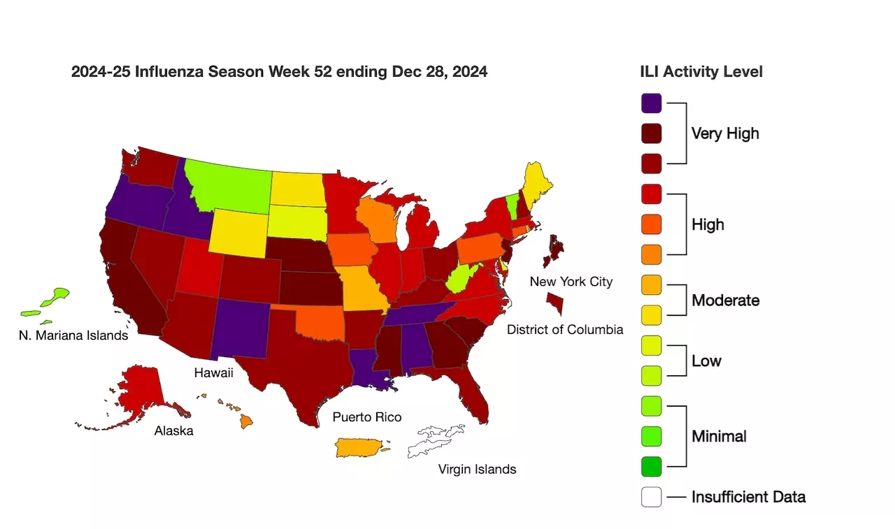 Flu Season Arrives Later Than Expected HEALTH