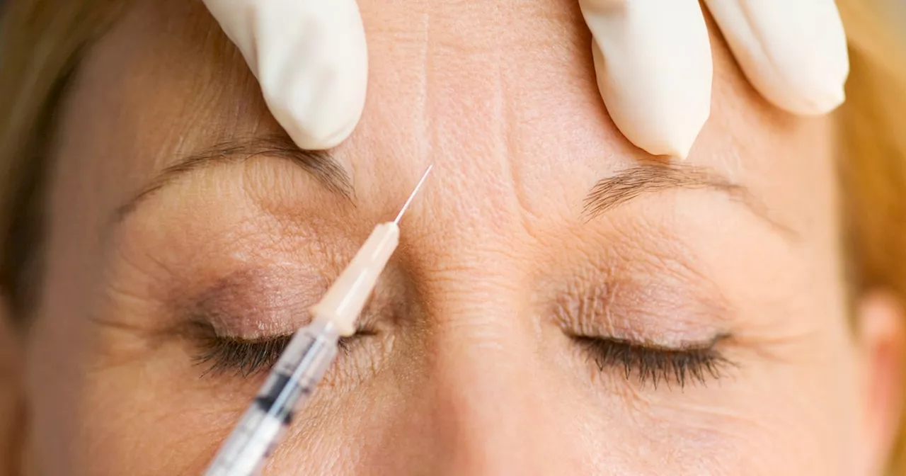 Faltenbehandlung: Botox, Hyaluronsäure & Facelifting – Die besten Methoden im Überblick