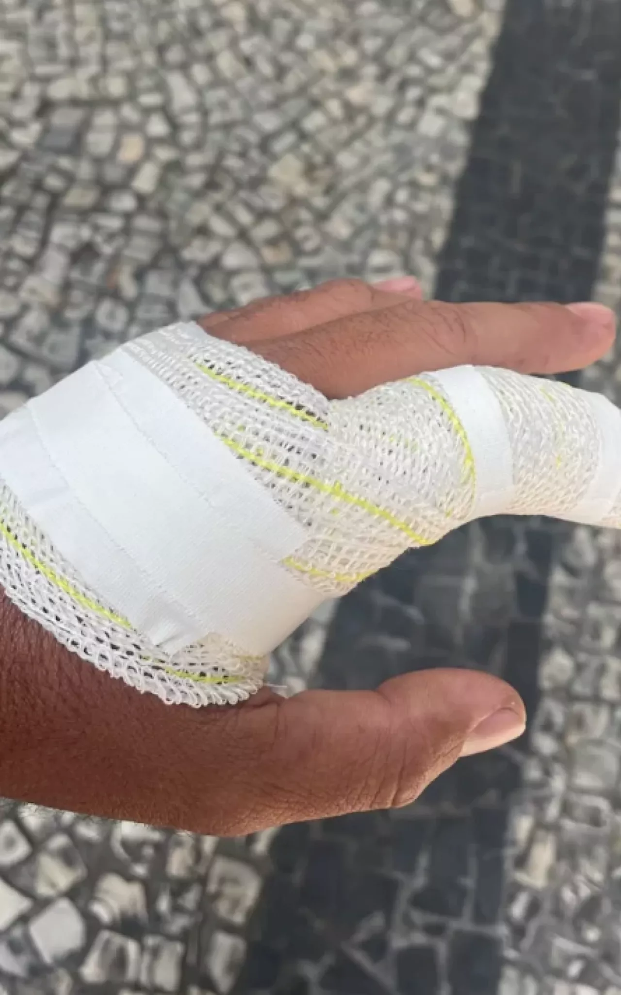 Turista é agredido após questionar taxa de serviço em quiosque em Cabo Frio