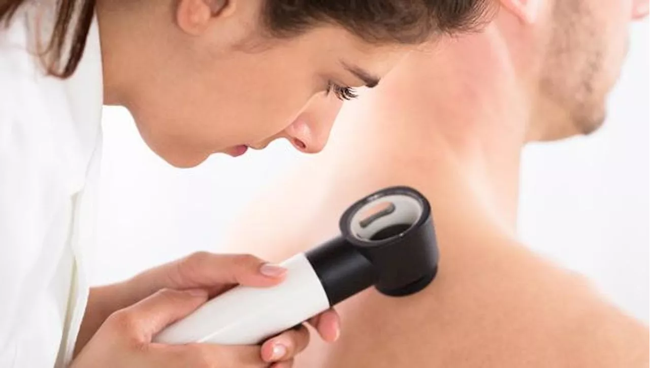 Melanoma, nel 2024 aumentano del 30% le diagnosi