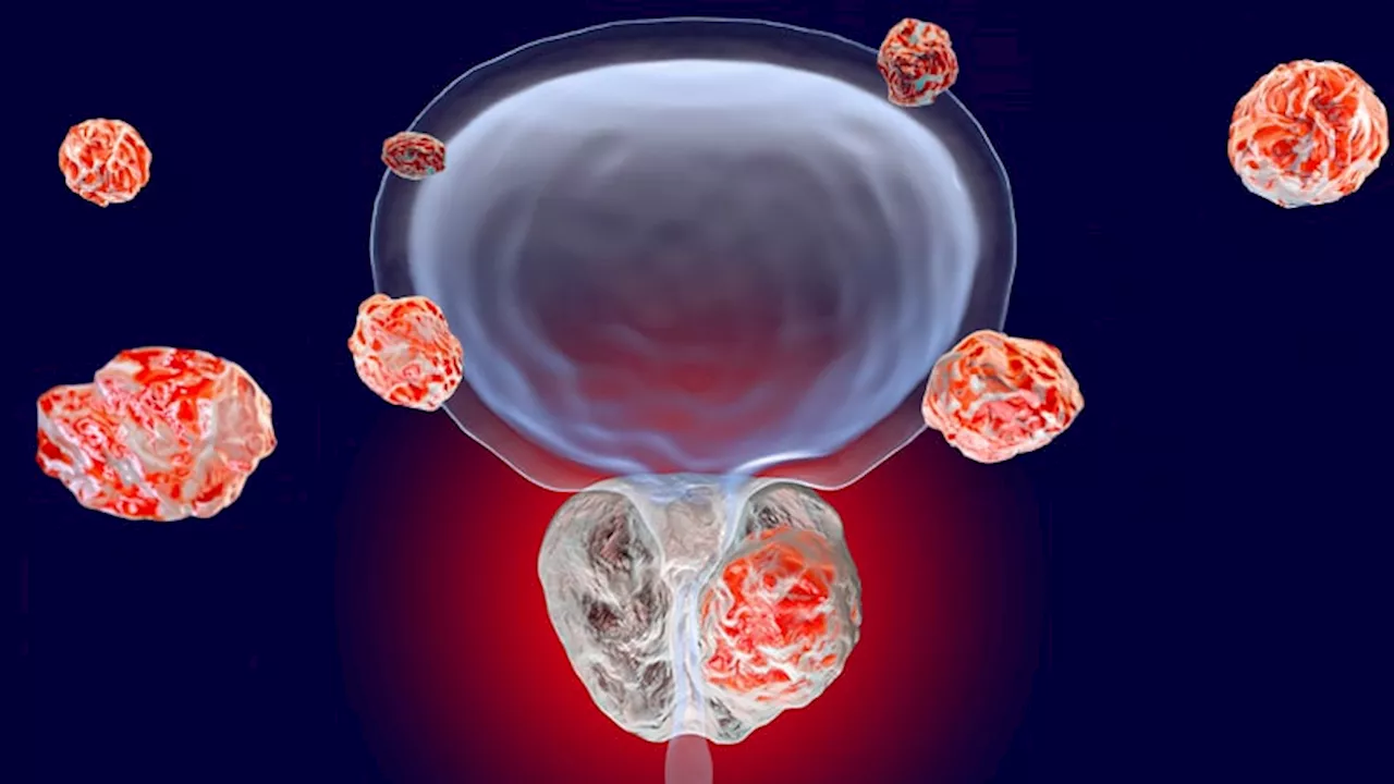 PSMA-PET Detects Metastatic Disease in High-Risk Prostate Cancer