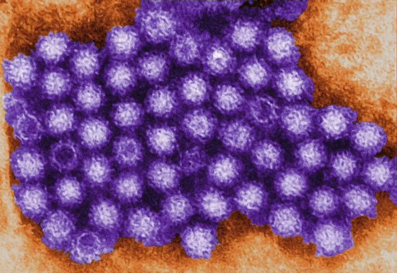 Norovirus Outbreaks Surge in New Jersey