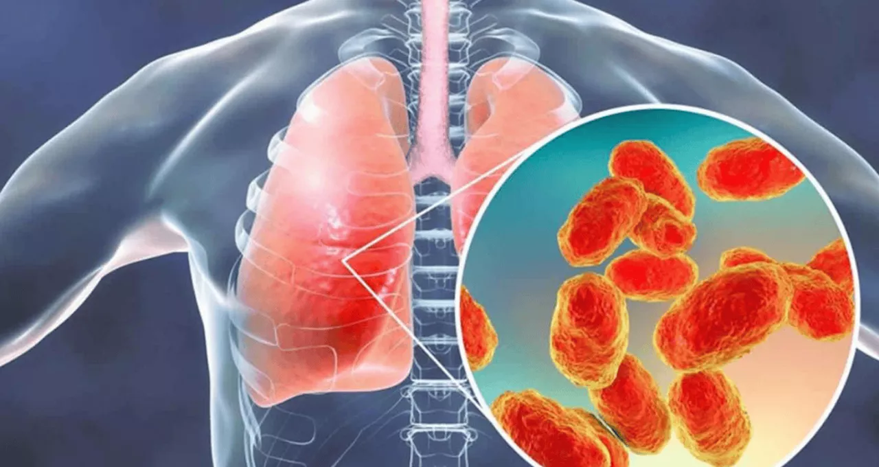 Metpneumovirus Humano (HMPV): Conocimiento y Prevención