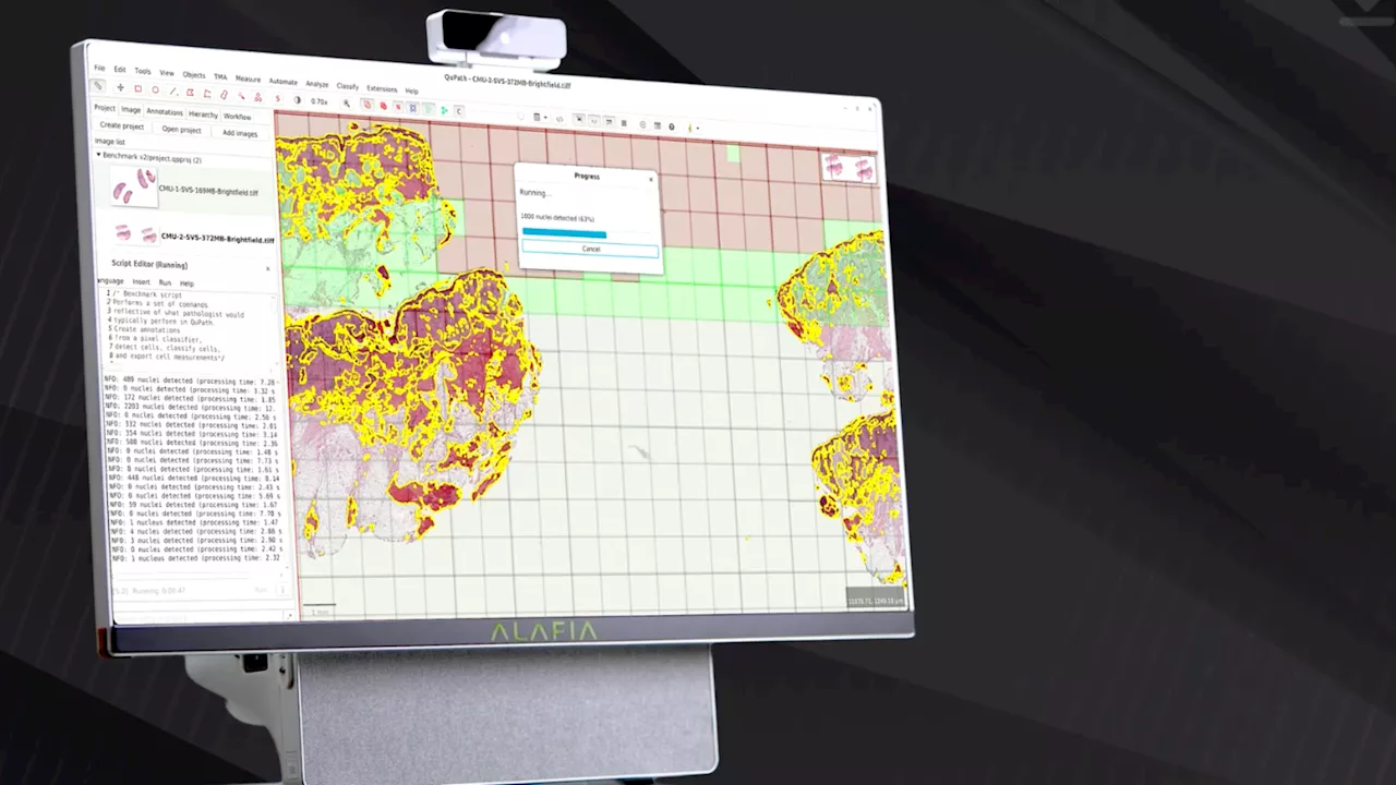 ALAFIA AI Unveils AIVAS: A Personal Supercomputer to Power Healthcare AI