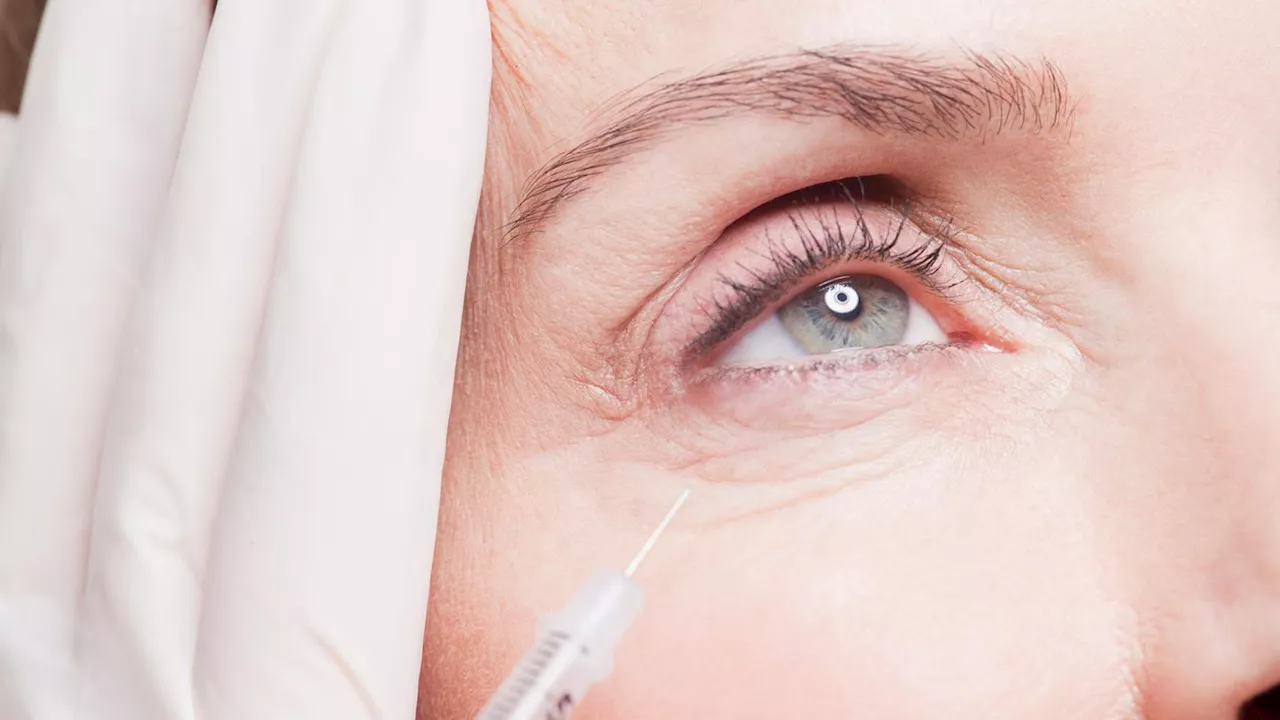 Botox und Filler: Die häufigsten Fragen beantwortet