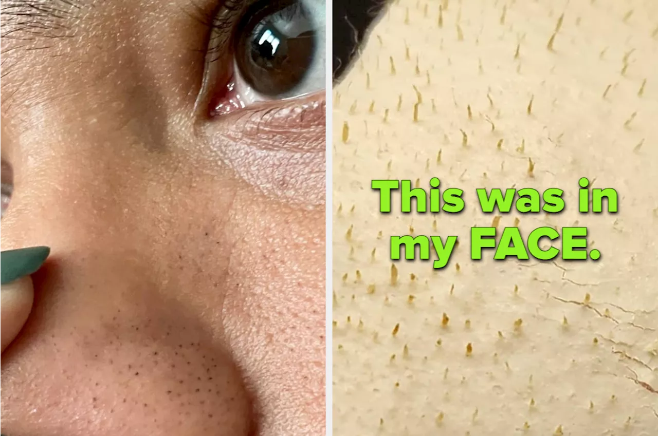 38 Products With Jaw-Dropping Results, According to Reviewers