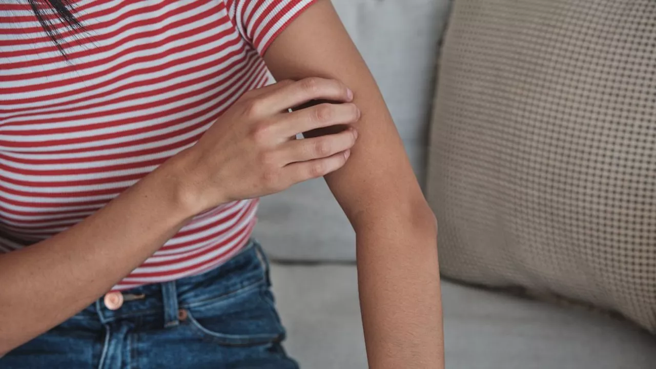 Why Itching Might Be More Than Just an Irritation