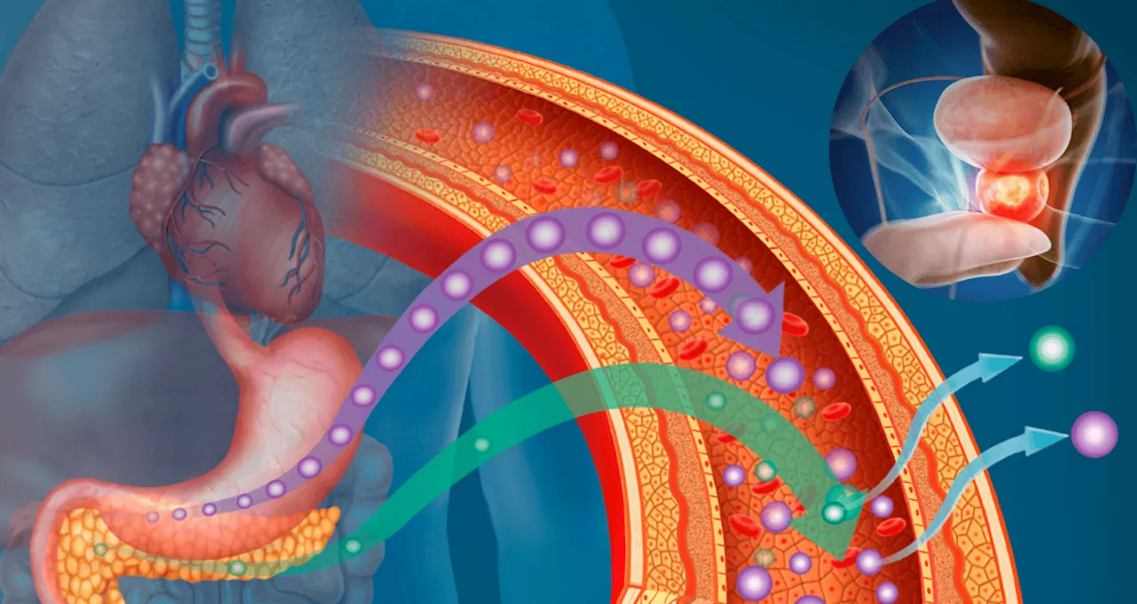 Diabetes y cáncer de próstata: ¿Menos riesgo o menor protección?