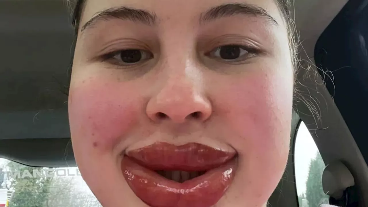 Woman's Lip Tattoo Goes Wrong, Leaves Her Looking Like 'Monsters Inc.' Character