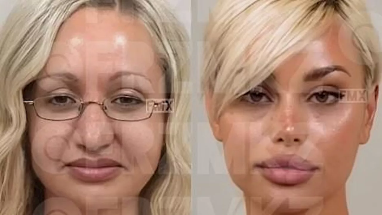 Social media goes wild for 'unbelievable' plastic surgery transformations that turn ordinary women...