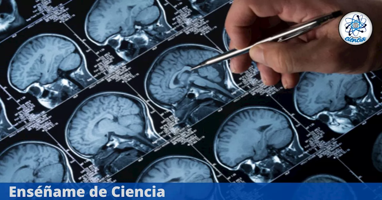 Proteína Beta Amiloide: ¿Un Nuevo Factor de Riesgo en el Alzheimer?