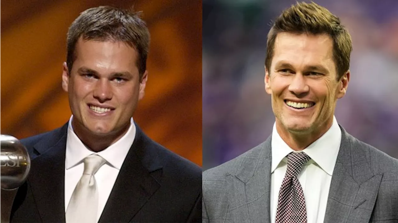 Tom Brady's Super Bowl Appearance Fuels Plastic Surgery Rumors