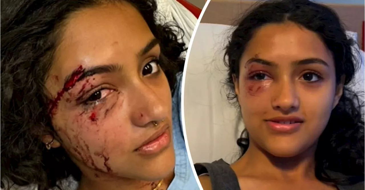 Teenager Recalls Being Hit by Car That Allegedly Flew the Scene