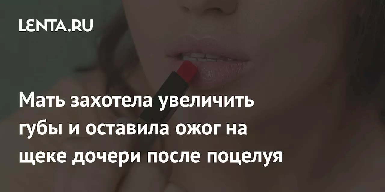 Мать захотела увеличить губы и оставила ожог на щеке дочери после поцелуя