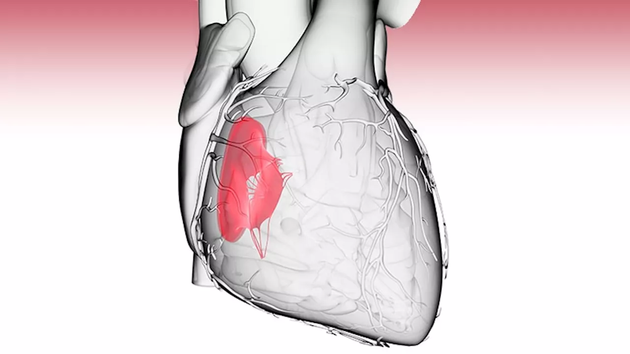 Changing Landscape of Tricuspid Valve Repair: Surgery vs. Transcatheter Approaches