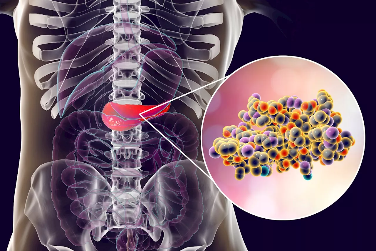 Adrenomedullin hormone as key driver of insulin resistance in obesity-linked type 2 diabetes