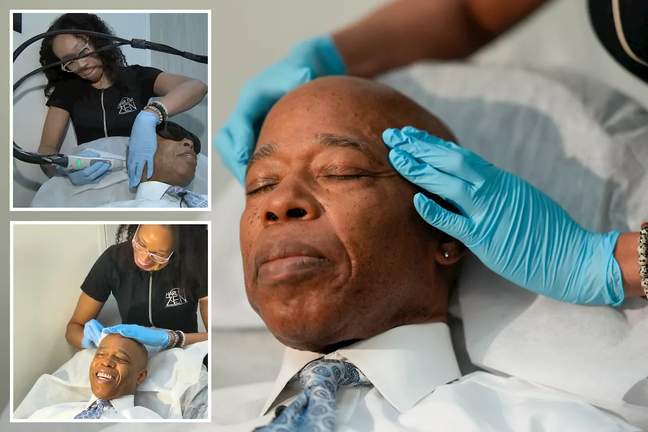 Mayor Eric Adams Gets Laser Hair Removal During Small Business Promotion