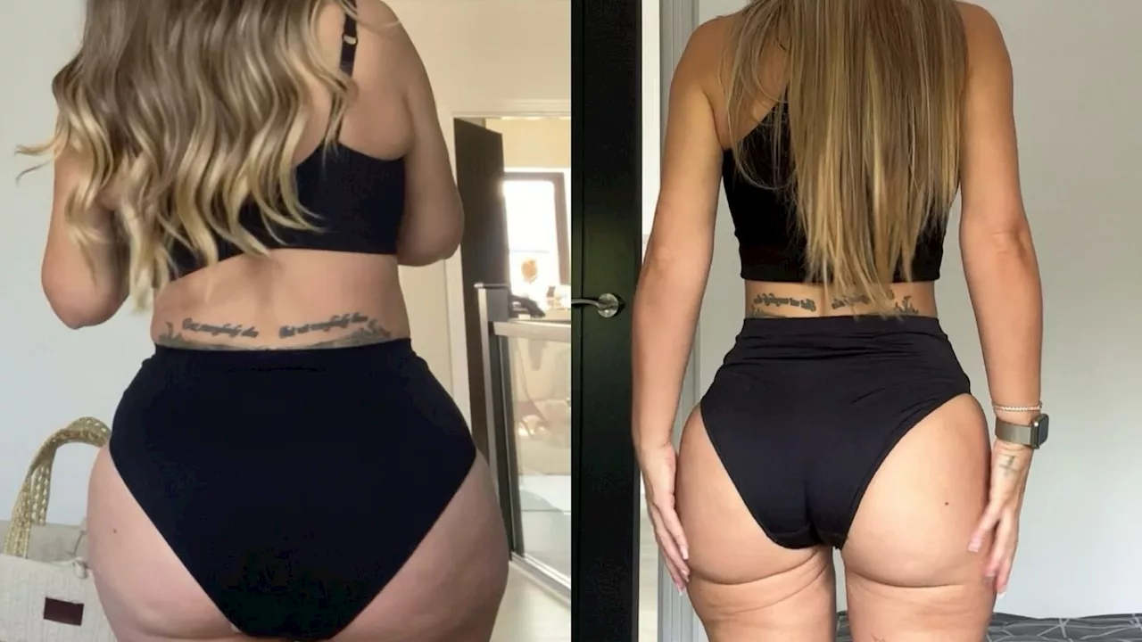 Holly Hagan Regrets Brazilian Butt Lift, Emphasizes Body Positivity