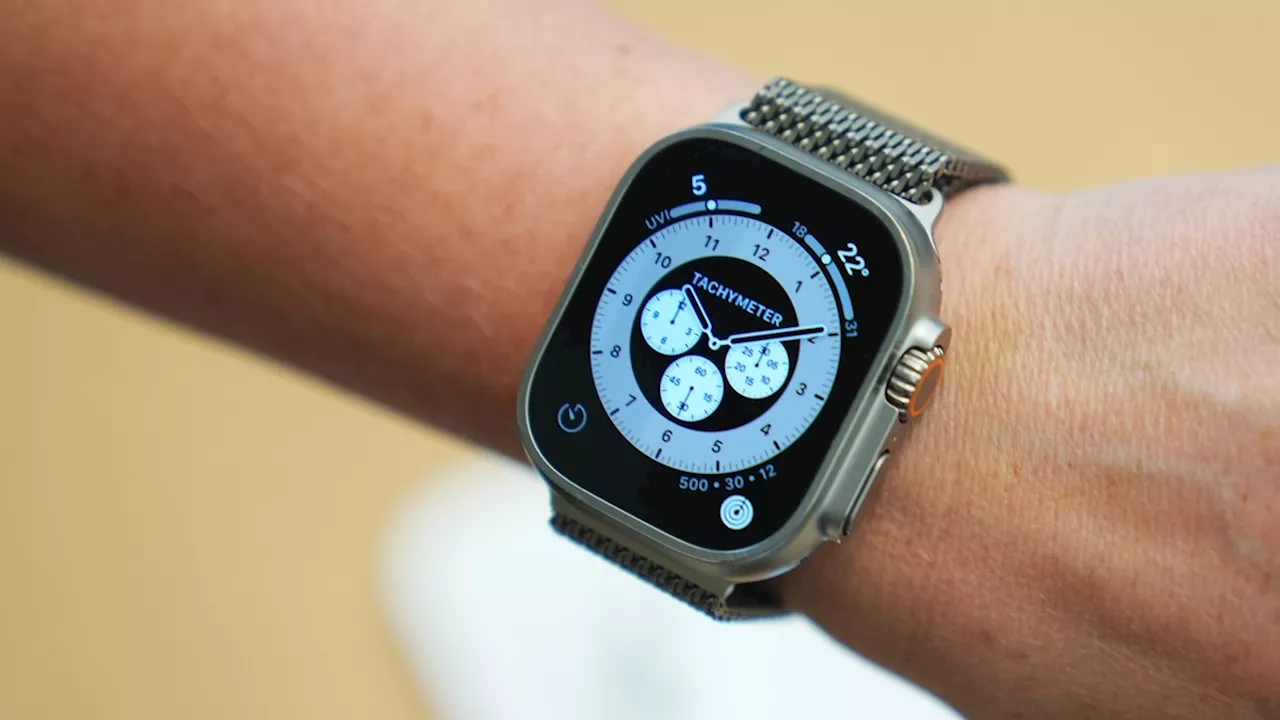 Apple Watch: Immer mehr Nutzer tragen Smartwatch an absurder Stelle