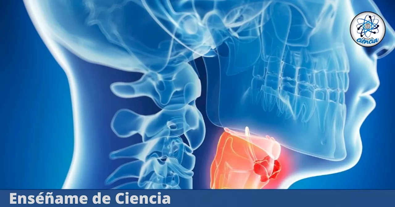 Cáncer de Garganta: Síntomas de Alerta y Precauciones