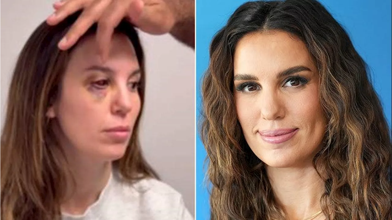 Christy Carlson Romano Says It's a 'Miracle' She Isn't Blind After Being Shot in the Face