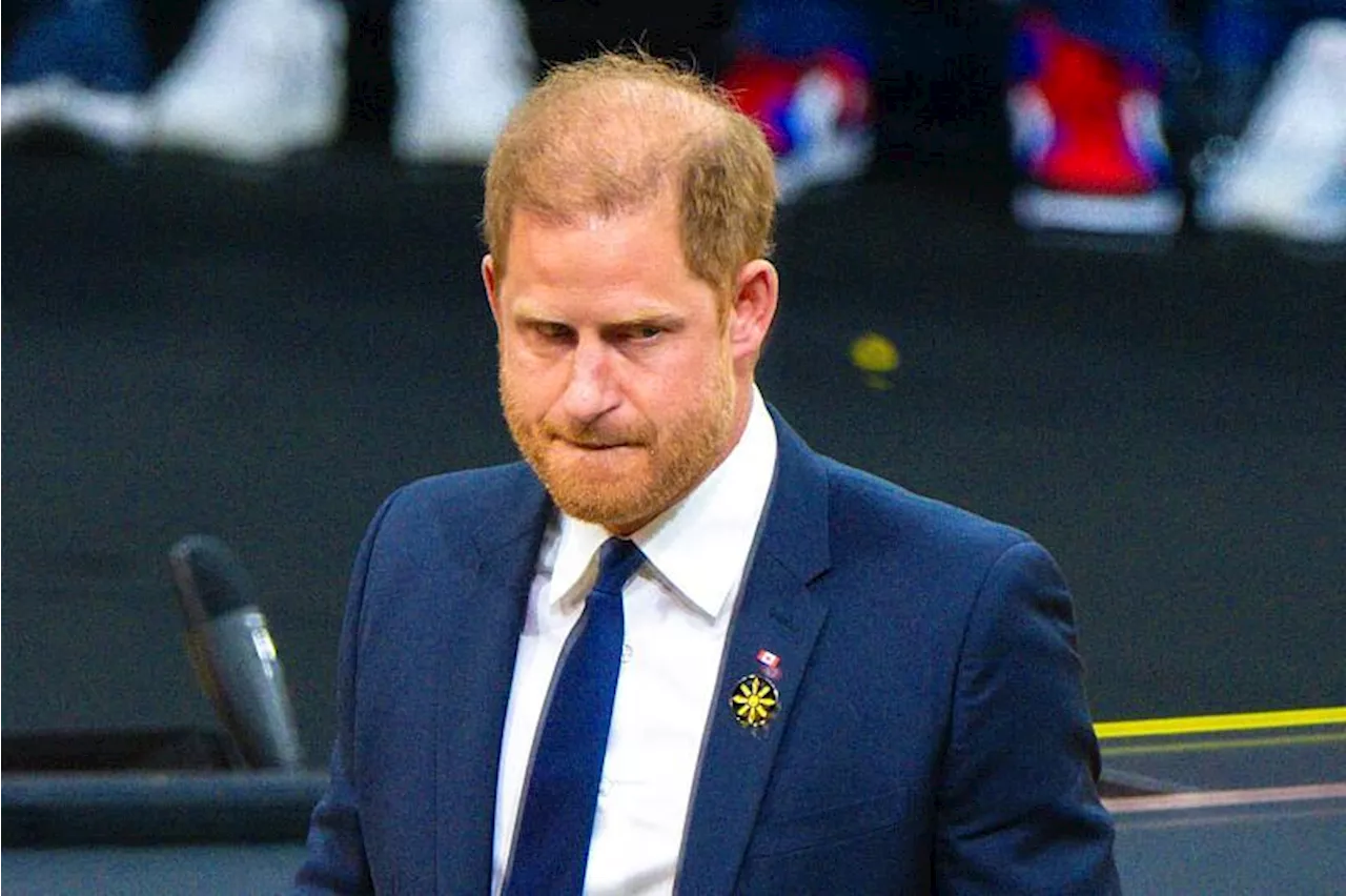 Le dilemme capillaire du prince Harry : greffe ou naturel ?