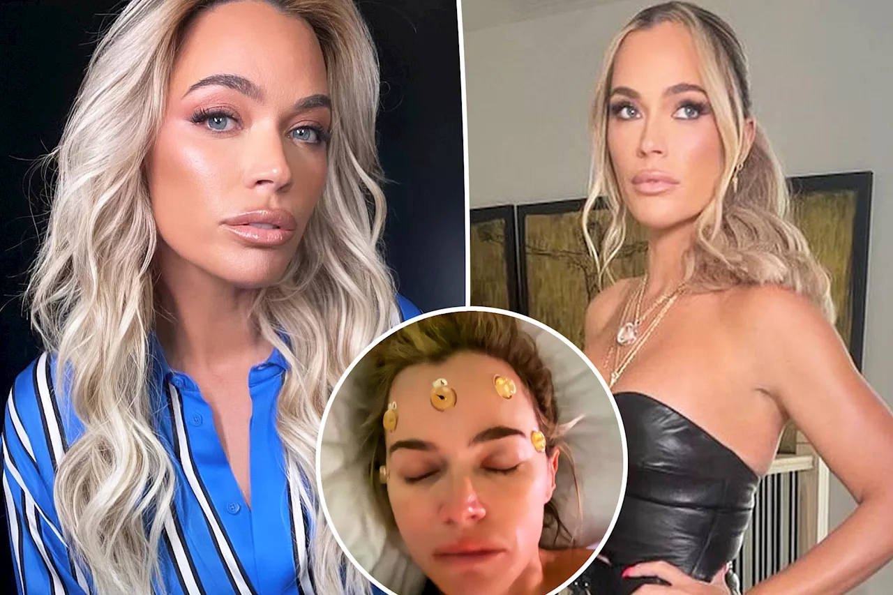 'RHOBH' alum Teddi Mellencamp diagnosed with 'multiple' brain tumors, reveals buzzed hair before emergency surgery