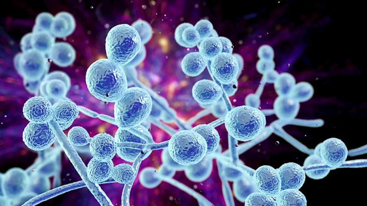 Travel Patterns May Play a Role in the Spread of Candida auris