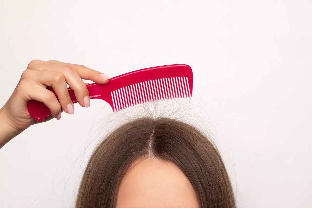 Taming the Winter Static: Haircare Tips for Dry Months