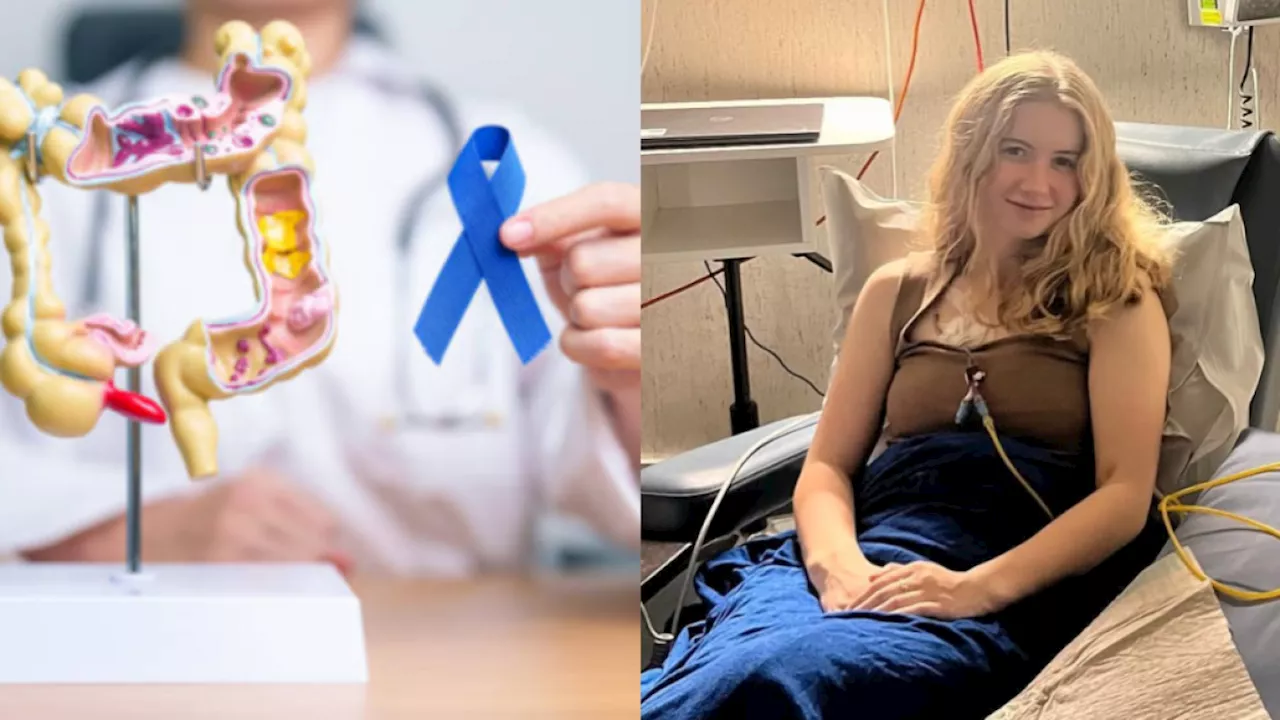 Joven diagnosticada con cáncer de colon a los 20 años reveló los síntomas que ignoró