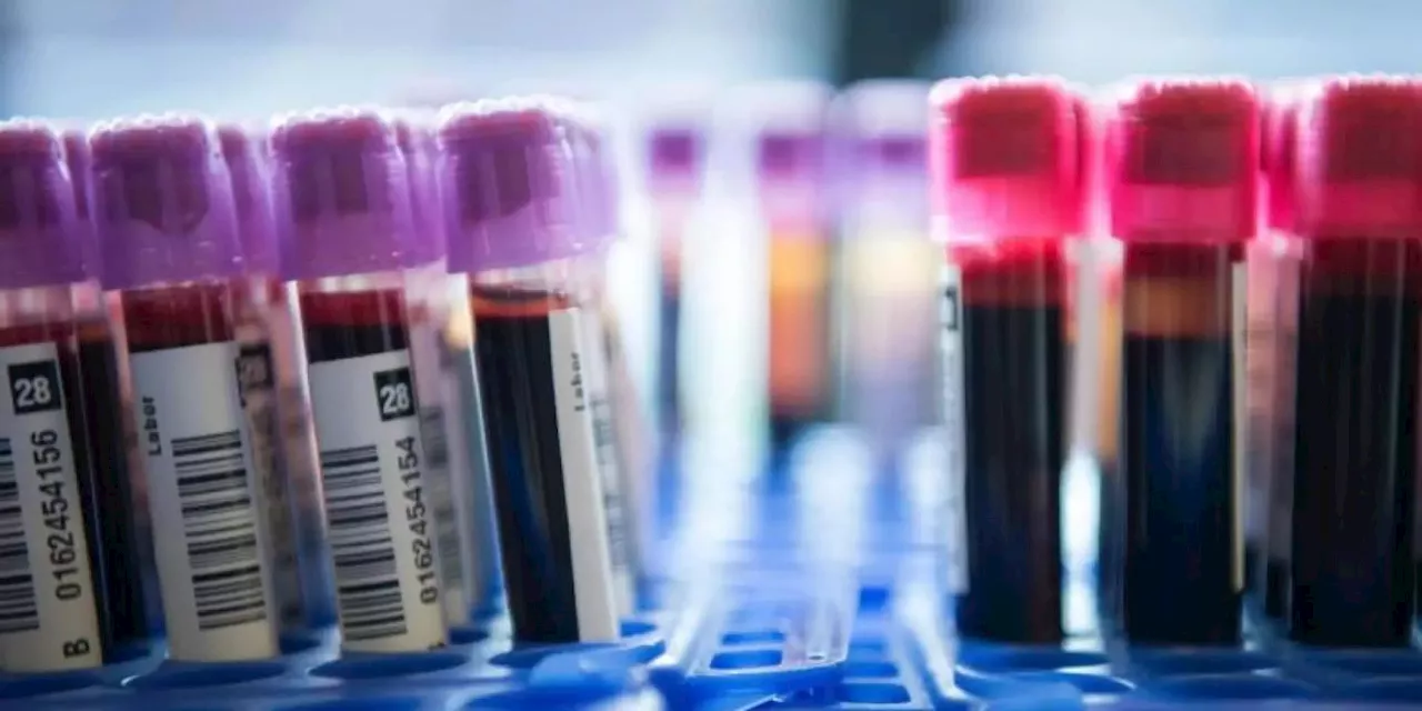 Ärzte übersehen bei Patientin sieben Jahre lang Blutkrebs