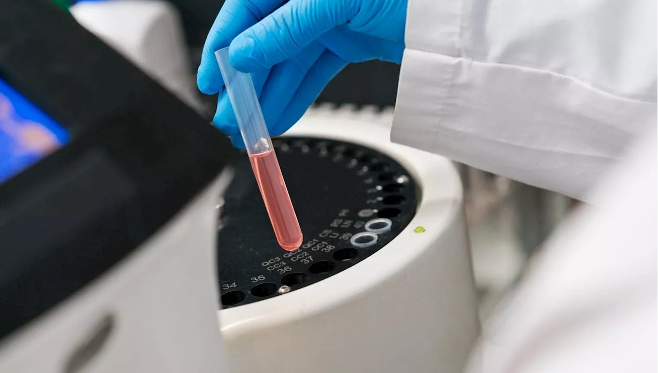 Infarto e ictus, tre test per conoscere il rischio di trombosi e farmaci da usare