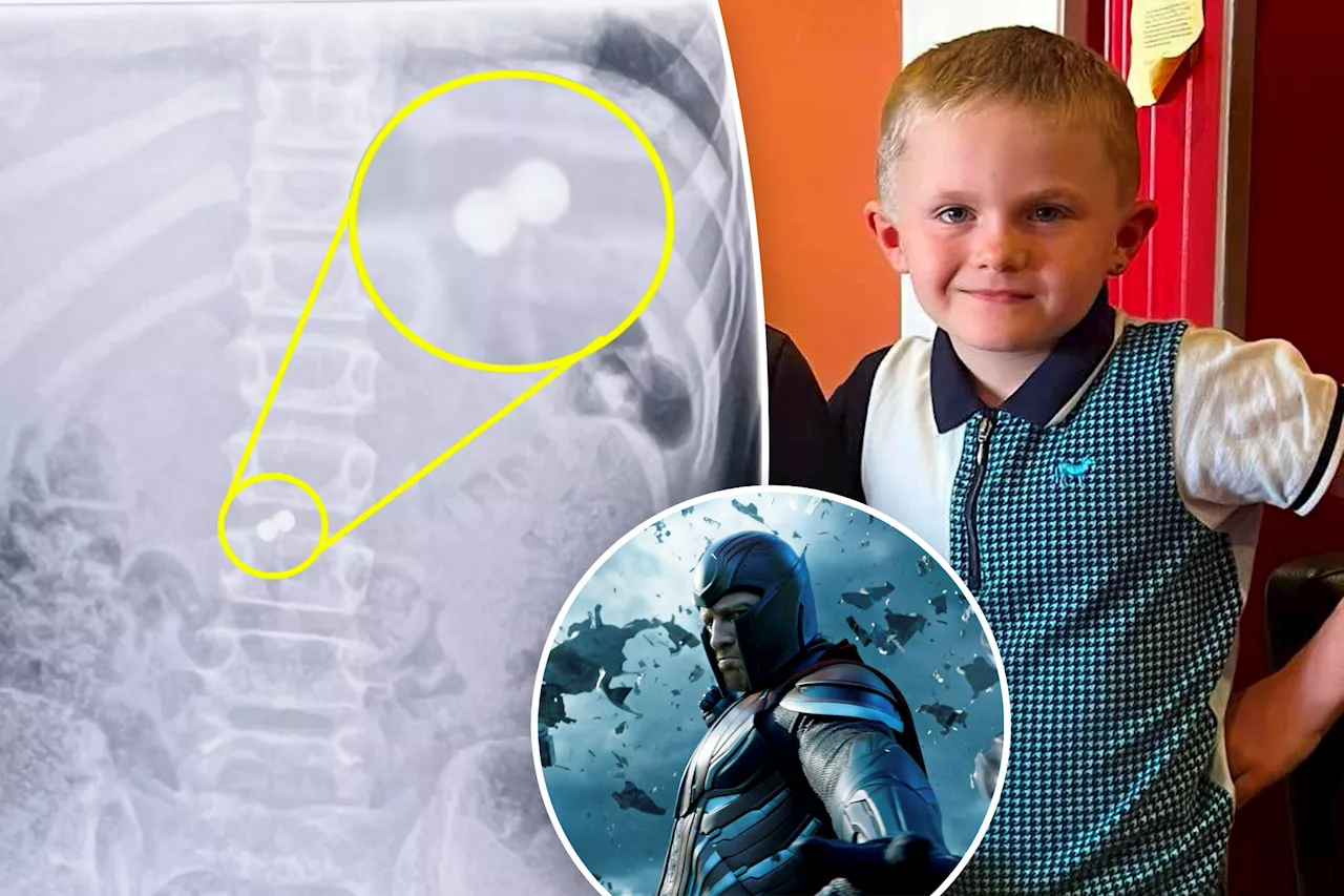 Boy swallows toy magnets, becomes X-Men's Magneto in freak accident: 'He burst out crying'