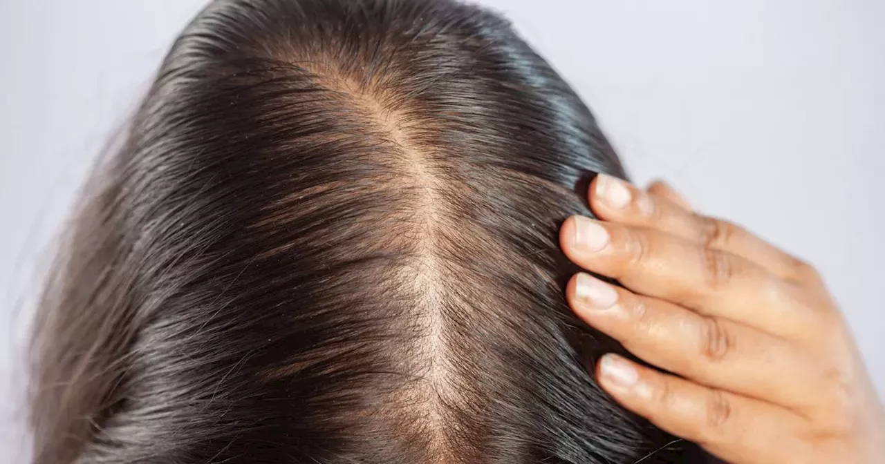 Beauty lovers say ‘miracle’ scalp serum ‘helps so much with hair growth’ and it’s 20% off