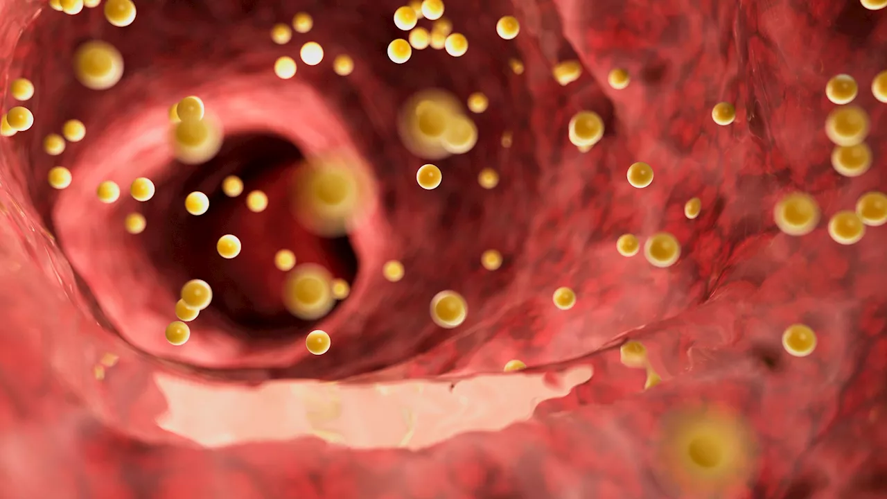 Identifican la alteración de una proteína clave en la enfermedad hereditaria de colesterol