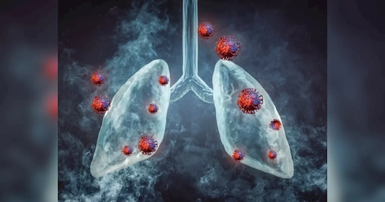 Lung Cancer अब सिर्फ स्मोकर्स की बीमारी नहीं, इन लोगों को भी ज्यादा खतरा, लैंसेट की स्टडी में सामने आई डराने वाली सच्चाई!