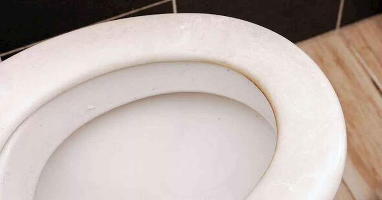 Banish loo seat stains in 30 seconds with one natural item