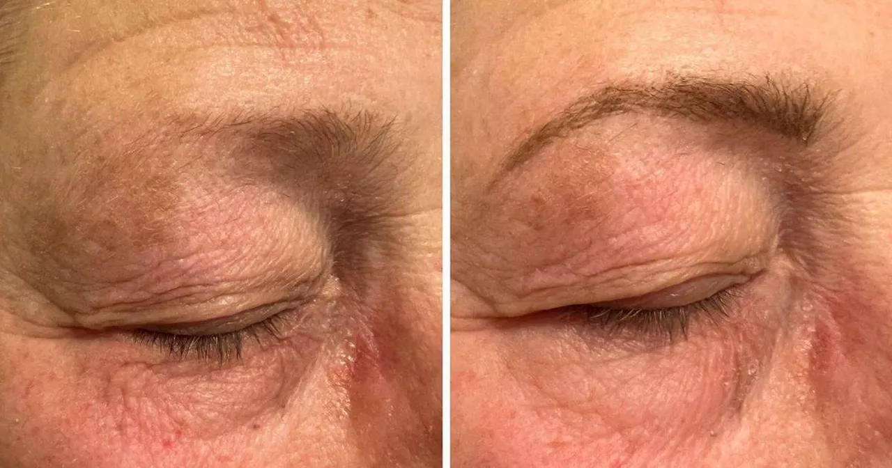 Benefit's Mighty Fine Brow Pen Helps Woman Reclaim Natural-Looking Brows After Chemotherapy