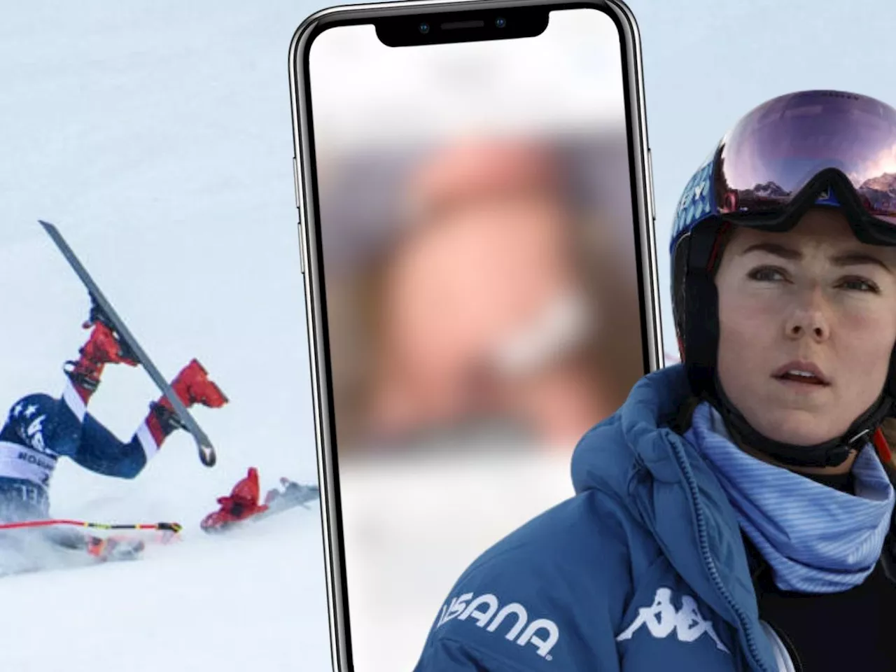 Mikaela Shiffrin zeigt Verletzungen nach schwerem Sturz in Killington