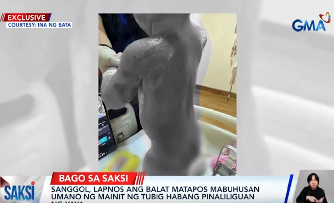 Baby Suffers Burns After Being Scalded by Yaya in Bulacan