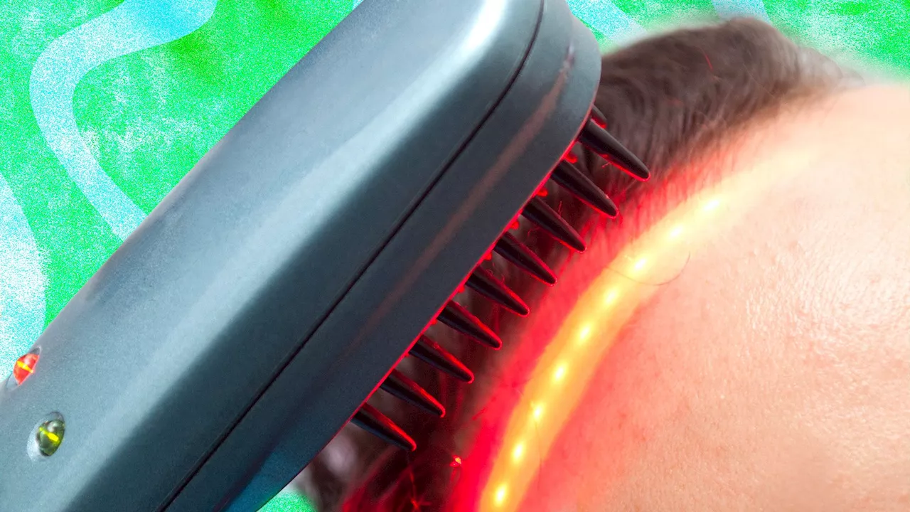 Un Casque LED Cheveux pour un Cuir Chevelu Plus Sain