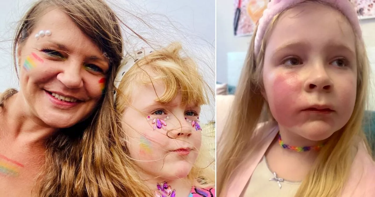 Girl, 5, suffers 'red burn' over her face after mum kissed her wearing lipgloss