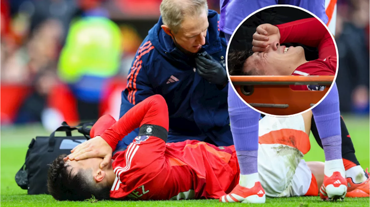 Man Utd issue devastating Lisandro Martinez injury update as club statement released