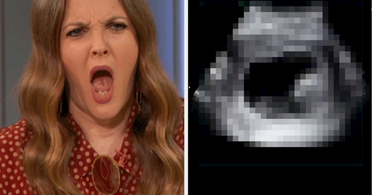 Woman's Hilarious Ultrasound Video Goes Viral