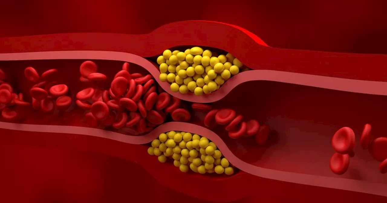 Lower Cholesterol in 10 Days: Doctor's Advice on Diet Changes